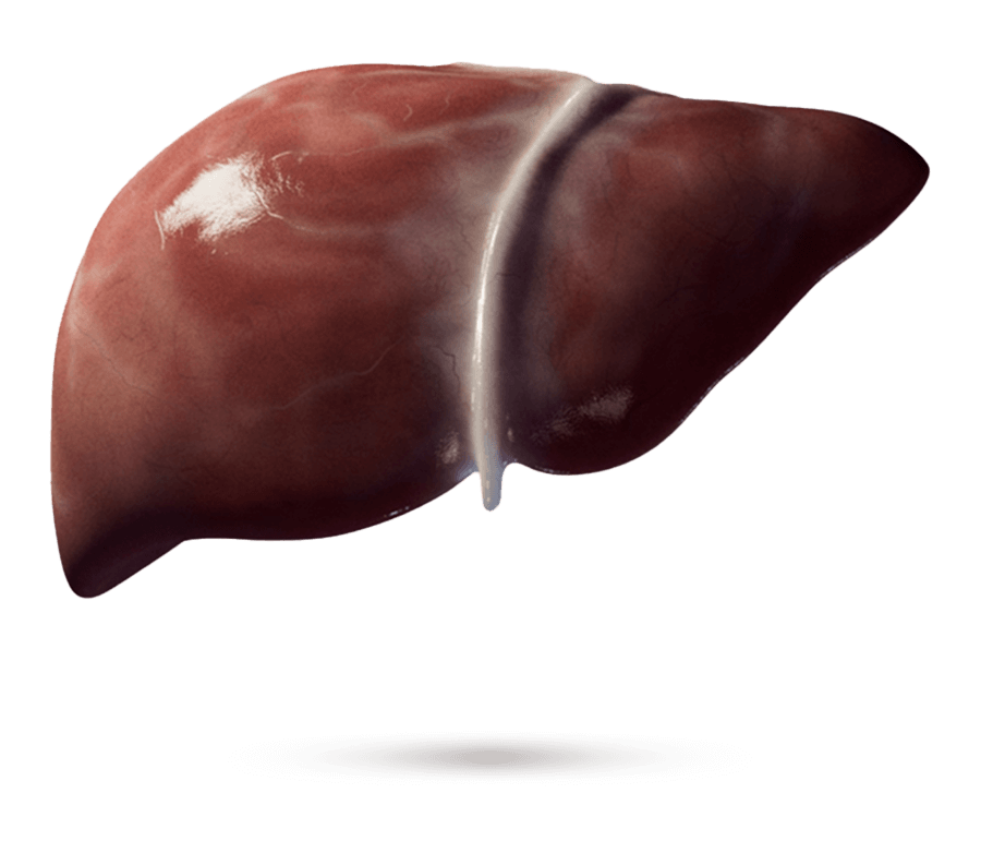Illustration médicale d’un foie avec fibrose apparente.